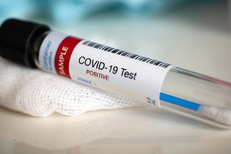 Azərbaycanda vəzifəli şəxsdə koronavirus aşkarlandı