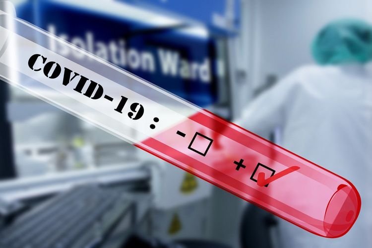 Azərbaycanda daha 191 nəfərdə koronavirus aşkarlanıb, 2 nəfər vəfat edib